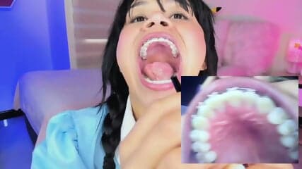 lila_moon_2021-03-16 endoscope mouth fetish