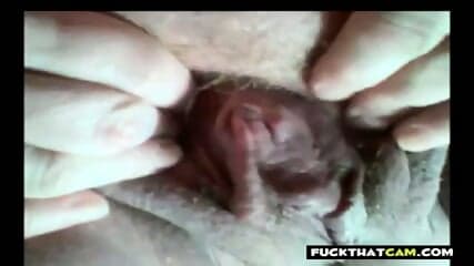 French Aunty's Private Gyno Cam Exam